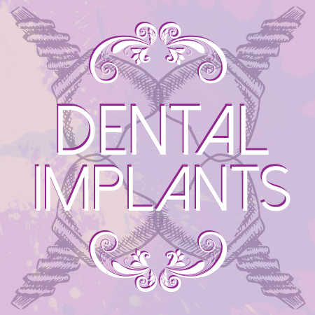 Dental_Implants (1)